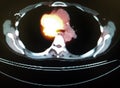 Pet ct tumor mediastinum penetrating lung frame Royalty Free Stock Photo