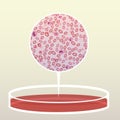 Petri Dish with Blood, Magnified Area - Vector Illustration