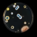 Petri dish with molds