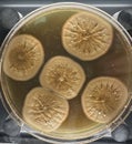 Petri dish with molds, penicillium, yeast, mucor isolated on black