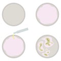 Petri dish set, empty and with a nutrient microbiological medium, also with a colony of bacteria, scientific equipment and