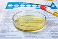 Petri dish with urine sample for analysis on laboratory form Royalty Free Stock Photo