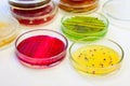 Petri dishes with bacterial colonies