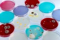 Petri dishes in the workbench of lab