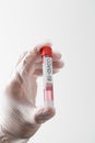 COVID-19 Pandemic COVID-19 Vaccination test for Corona virus patients Royalty Free Stock Photo