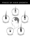 Phase of human hair growth cycle catagen, telogen, early, anagen phase, illustration on white background