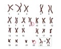 Philadelphia chromosome karyotype