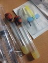 Phlebotomy Blood Tubes with Butterfly Angiocath Needle