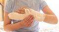 Photo of a broken arm of a child in a plaster case, an injury to the hand as a result of an accident, a fracture of the