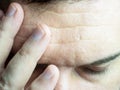 A close-up photo of man pressing his fingers to his forehead, wrinkling his forehead and closing his eyes, showing a Royalty Free Stock Photo