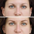 Photo comparison before and after permanent makeup, tattooing of eyebrows