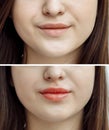 Photo comparison before and after permanent makeup, tattooing of lips