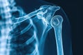 This photo depicts an x-ray image of the shoulder and the bones within it, X-ray visual of a human shoulder in 3D, AI Generated Royalty Free Stock Photo