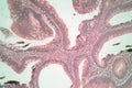 Photo of large intestine cells.