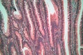 Photo of large intestine cells.