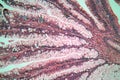 Photo of large intestine cells.