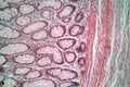 Photo of large intestine cells.