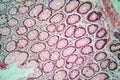 Photo of large intestine cells.