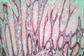 Photo of large intestine cells.