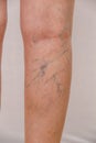 Photo of the legs of an old woman in white panties with cellulite and varicose veins on a light background. Royalty Free Stock Photo