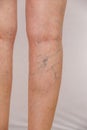 Photo of the legs of an old woman in white panties with cellulite and varicose veins on a light isolated background. Royalty Free Stock Photo