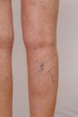 Photo of the legs of an old woman in white panties with cellulite and varicose veins on a light isolated background. Royalty Free Stock Photo