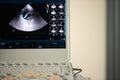 Photo of the screen of an ultrasound scanner with the image of a