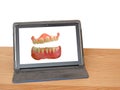 Laughing false teeth dentures on tablet computer screen