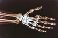 This photo shows an x-ray image of a hand belonging to a skeleton, with clearly visible bones and joints, A closer look at wrist Royalty Free Stock Photo