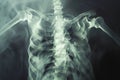 This photo shows an x-ray image of a persons torso, providing a view of the skeletal structure and organs within, Capturing the Royalty Free Stock Photo