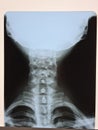 Photo of x-ray image of human neck Royalty Free Stock Photo