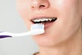 Photo of young woman with braces on her teeth brushing her teeth with a toothbrush close-up. dental and oral care Royalty Free Stock Photo