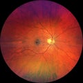 Photograph of the Fundus Oculi Royalty Free Stock Photo