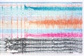 Photograph of ictal EEG during seizure