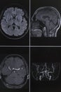 Photography of human brain magnetic resonance imaging