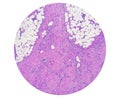 Photomicrograph of granulomatous tissue histology Royalty Free Stock Photo