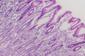 Photomicrograph of intestinal metaplasia