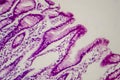 Photomicrograph of intestinal metaplasia