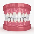 Photorealistic 3D dental model showing upper and lower human teeth with gums, front view Royalty Free Stock Photo