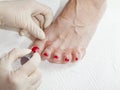 Photos of foot nail varnishing process, series of photos