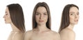 Photos of woman with lifting marks on face against white background, collage. Cosmetic surgery