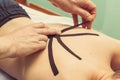 Physical therapist placing kinesio tape on patient s back