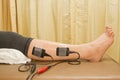 Physical therapy , woman with eletrical stimulator