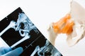 Physician, intern or student of medical university holds in his hand MRI CT scans of hip joint, comparing it with anatomical mod