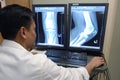 Physician reviewing digital x-ray scans