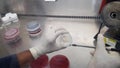 Picking up of pus sample from a sample container using an inoculation loop