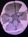 Brain computed tomography