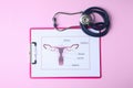 Picture of female reproductive system with stethoscope on color background. Gynecological care