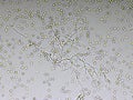 Picture of fungus and red blood cells in hemoculture tube