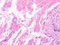 picture of histology human tissue with microscope from laboratory (not Illustration Designation) Royalty Free Stock Photo